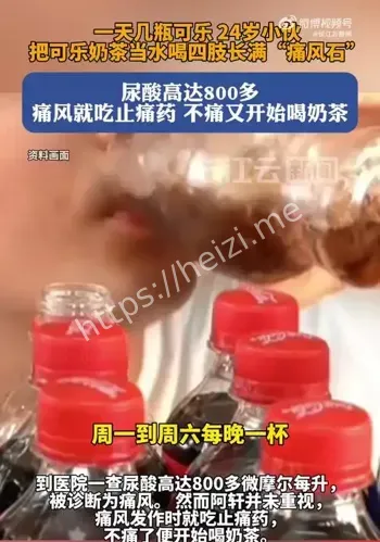 尿酸过高痛风石